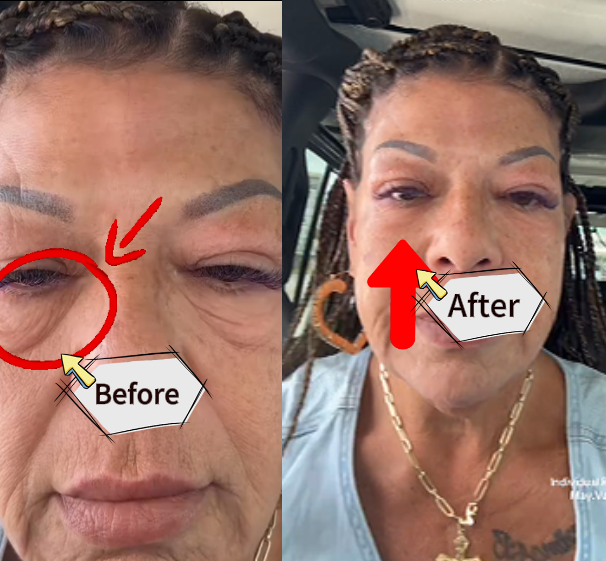 Before and After Results